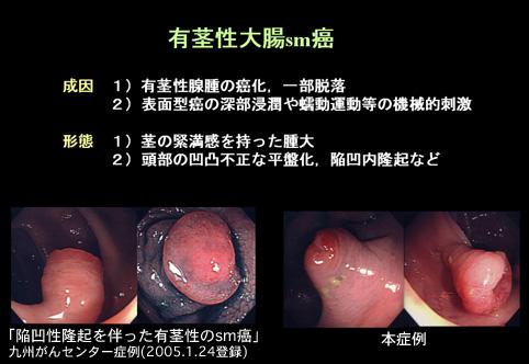 画像ID:7896