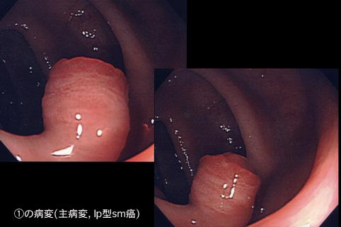 画像ID:7900