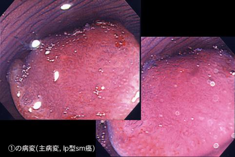 画像ID:7903