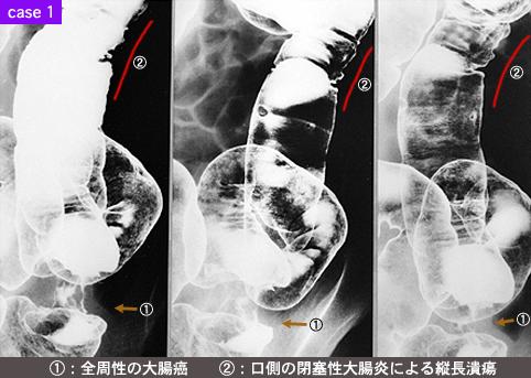 画像ID:8582