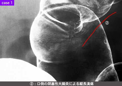画像ID:8587
