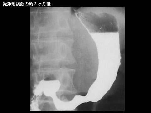 画像ID:8825