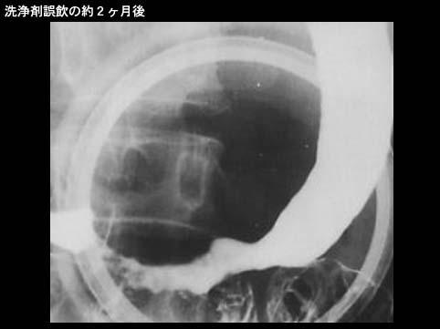 画像ID:8826