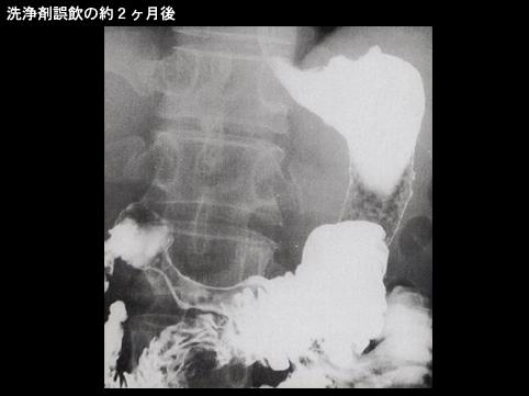 画像ID:8828