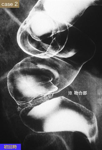 画像ID:9177
