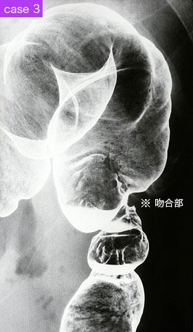 画像ID:9181