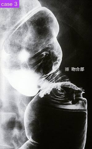 画像ID:9182