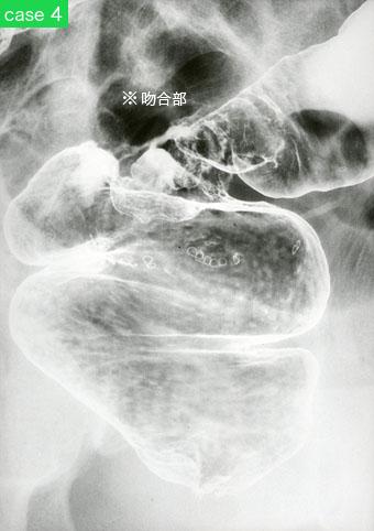 画像ID:9185