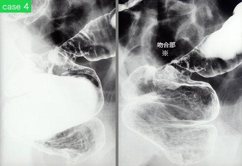 画像ID:9186
