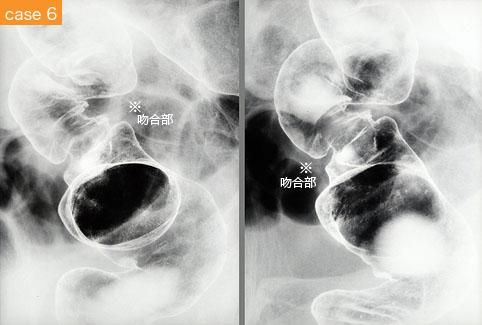画像ID:9188