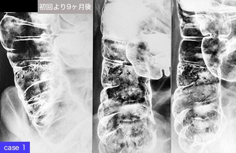 画像ID:9276