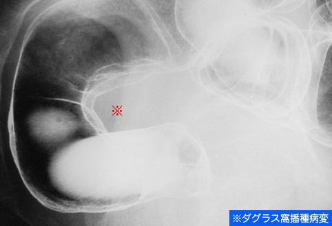 画像ID:9824