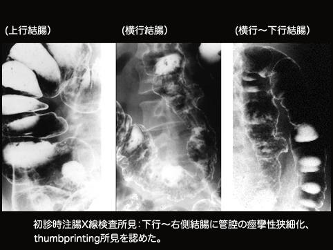 画像ID:10134