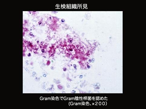画像ID:10142