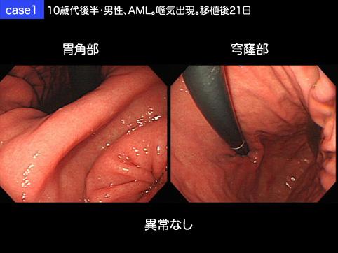 画像ID:10143