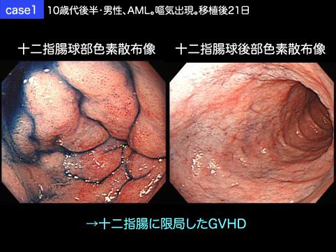 画像ID:10146