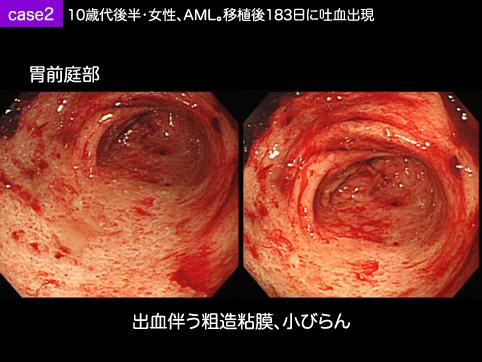 画像ID:10154