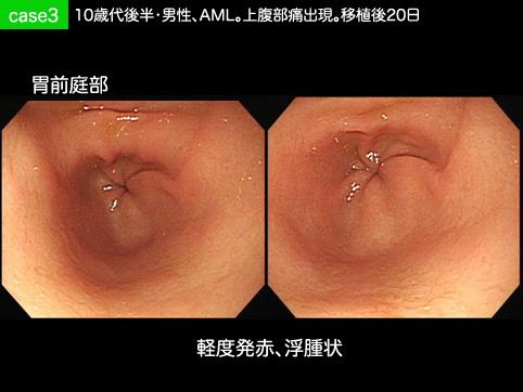 画像ID:10157