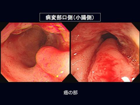 画像ID:10175