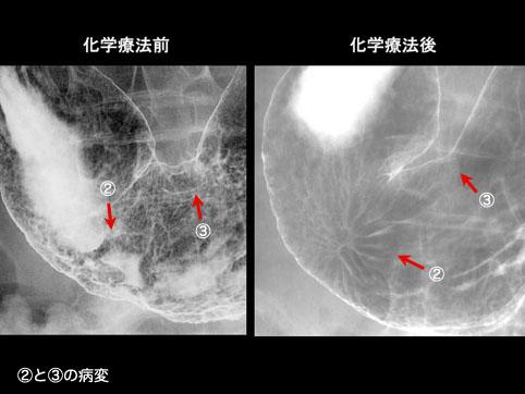 画像ID:10523