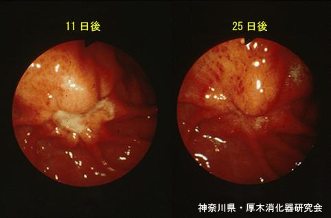画像ID:11031