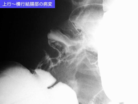 画像ID:11035
