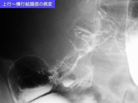 画像ID:11036