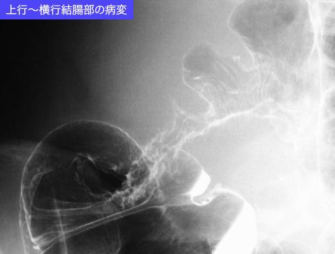 画像ID:11037