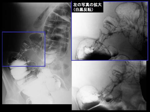 画像ID:11038