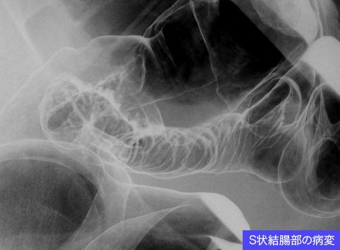 画像ID:11039