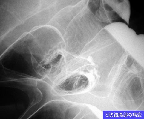 画像ID:11042