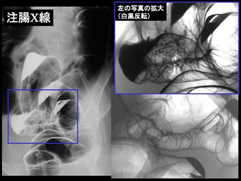 画像ID:11044