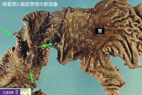 画像ID:11143