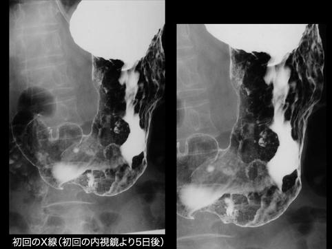 画像ID:11151