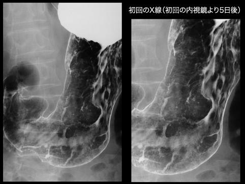 画像ID:11152