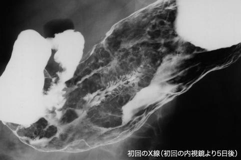 画像ID:11153