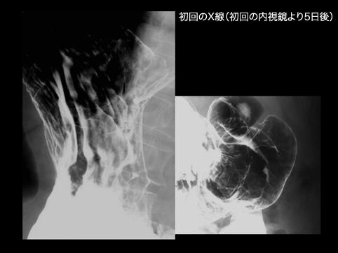 画像ID:11155