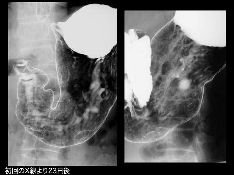 画像ID:11158