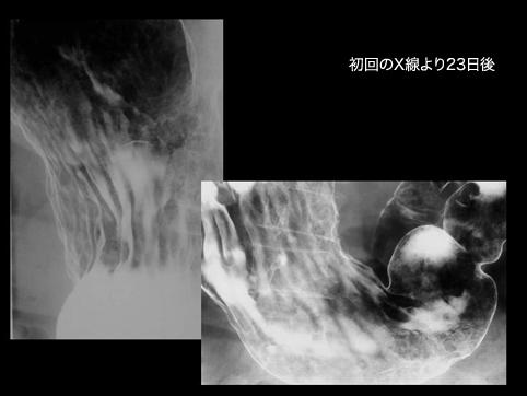 画像ID:11161
