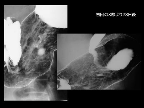 画像ID:11162