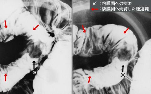画像ID:11182