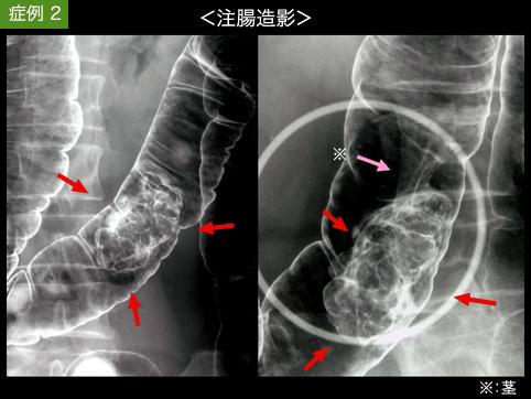 画像ID:11250