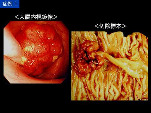 画像ID:11257