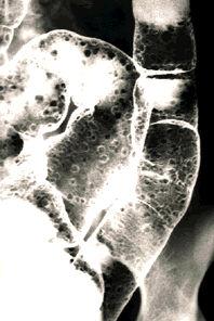 画像ID:45