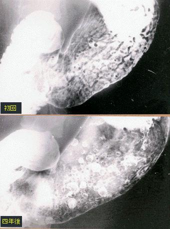 画像ID:151