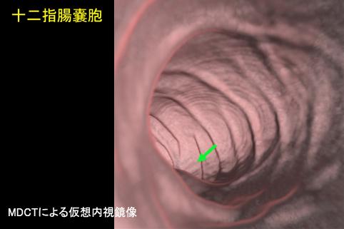 画像ID:11356