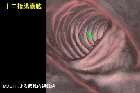 画像ID:11363