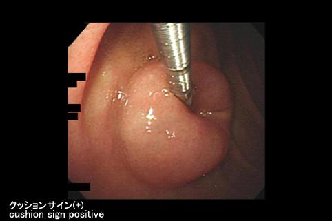 画像ID:11365