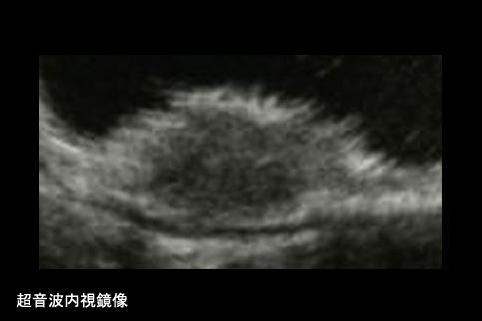 画像ID:11425