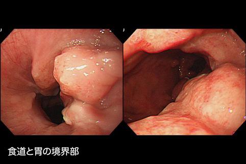 画像ID:11436